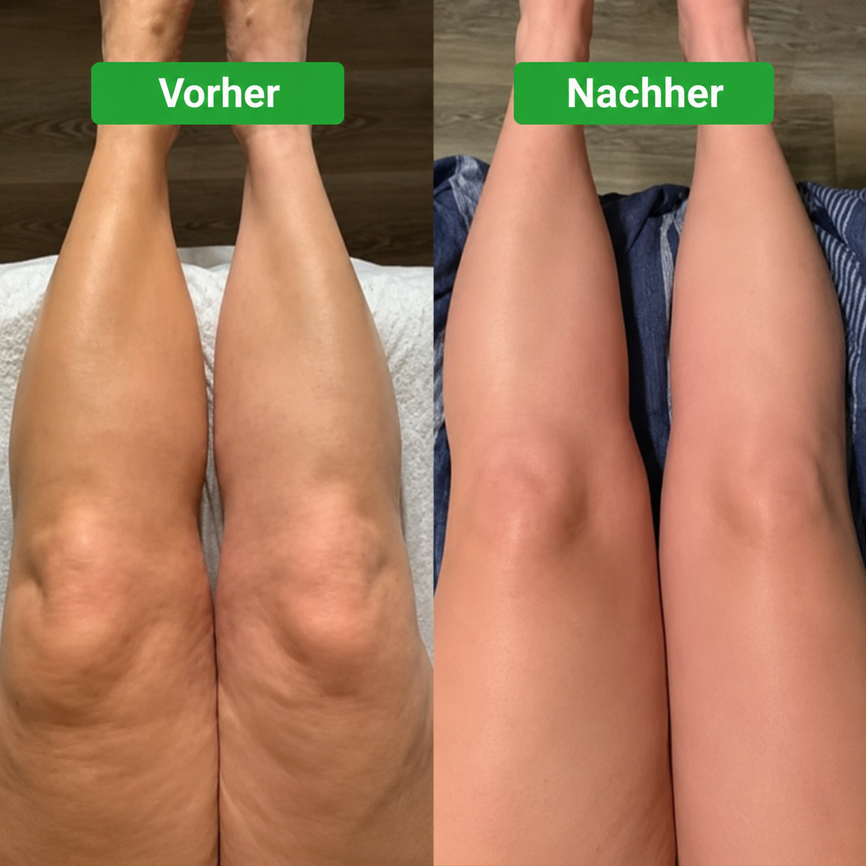 Lymphdrainage-Komplex